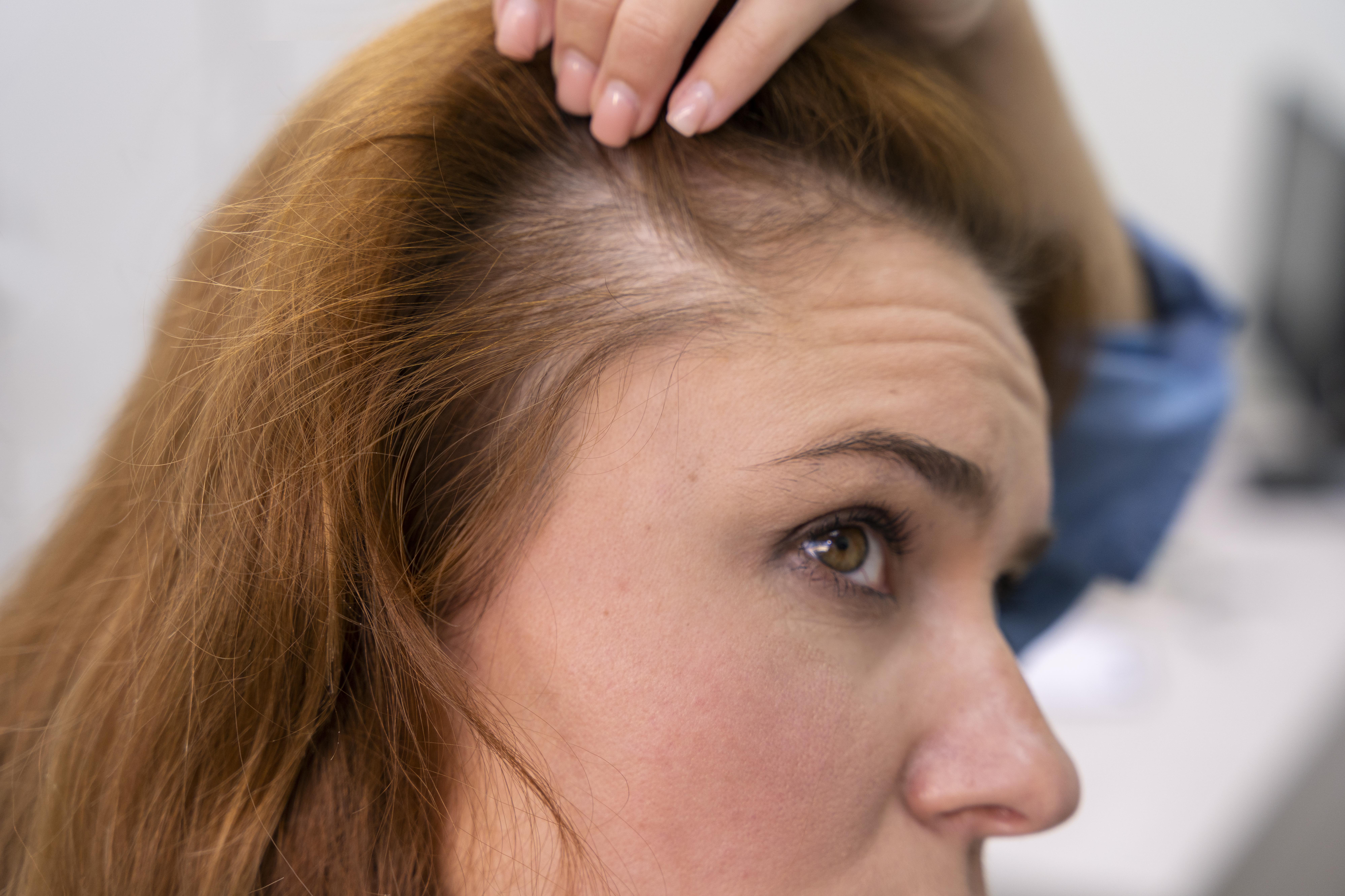 Descubra abordagens eficazes para um cabelo mais saudável e forte, incluindo métodos naturais e avançados de tratamento capilar feminino.