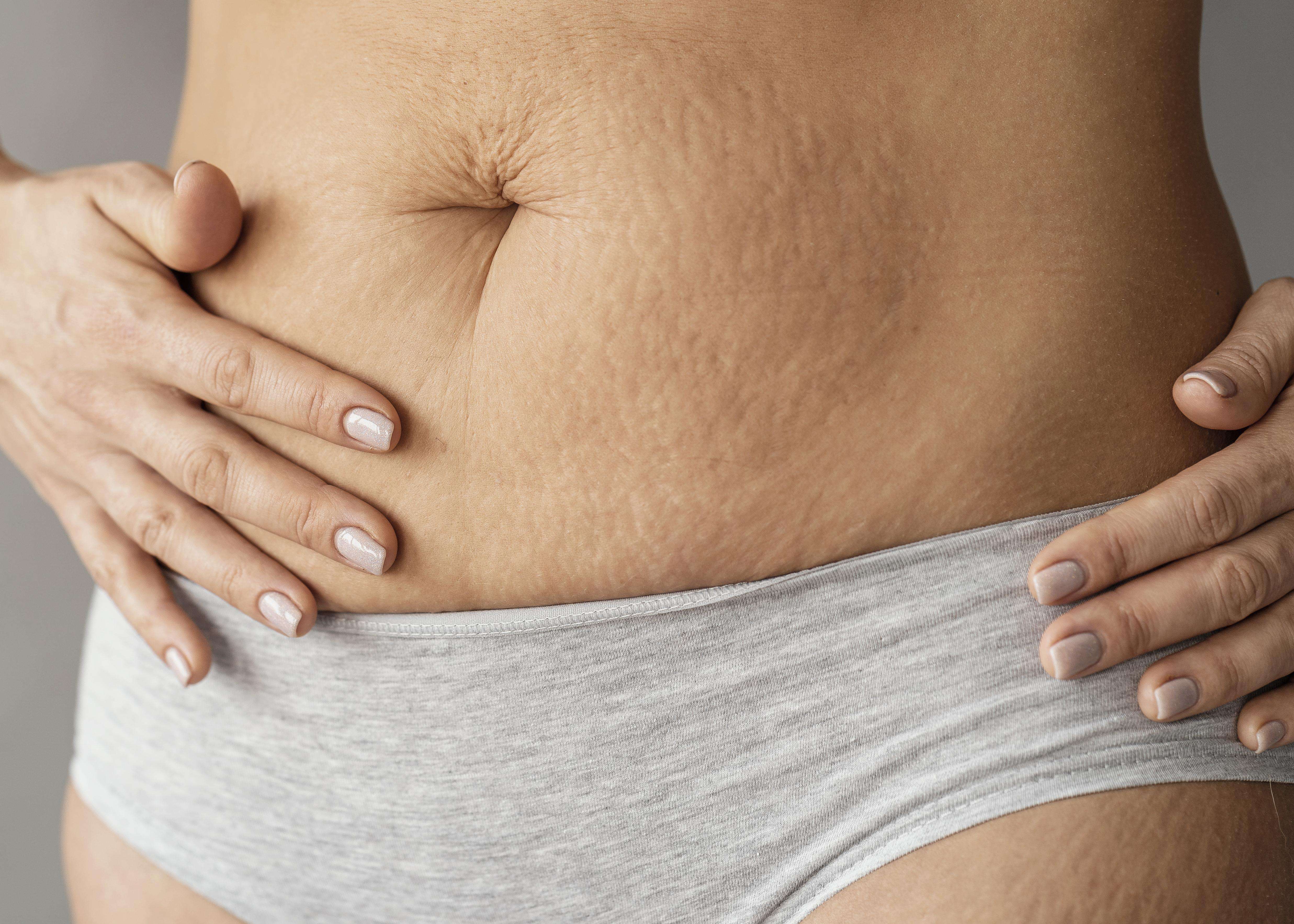 Descubra métodos eficazes para tratar a diástase abdominal pós-parto. Recupere a saúde do seu abdômen com exercícios e cuidados especiais.
