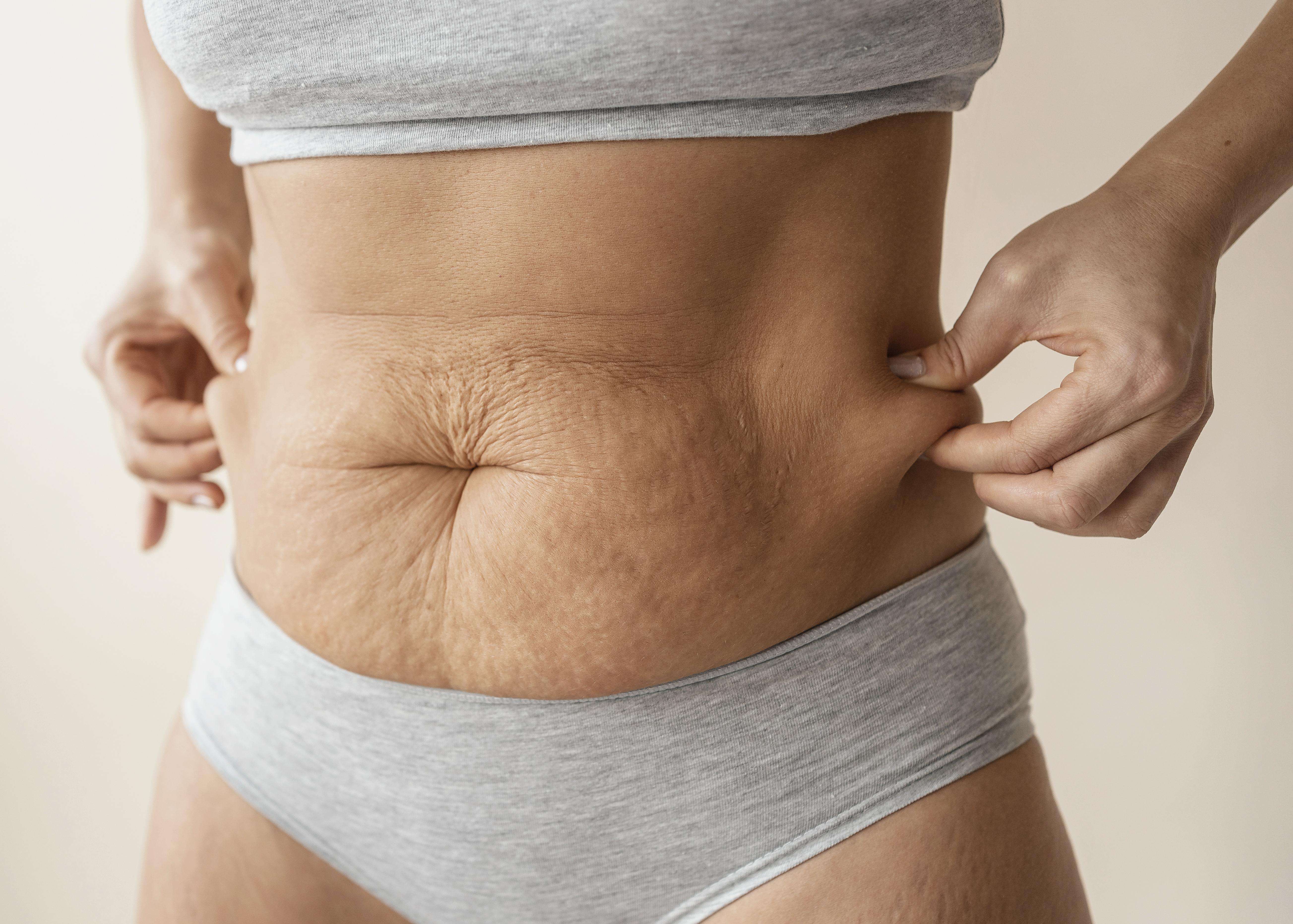 Descubra como evitar a diástase na gestação com dicas eficazes para cuidar dos músculos abdominais durante a gravidez. Prevenção e bem-estar para mães.
