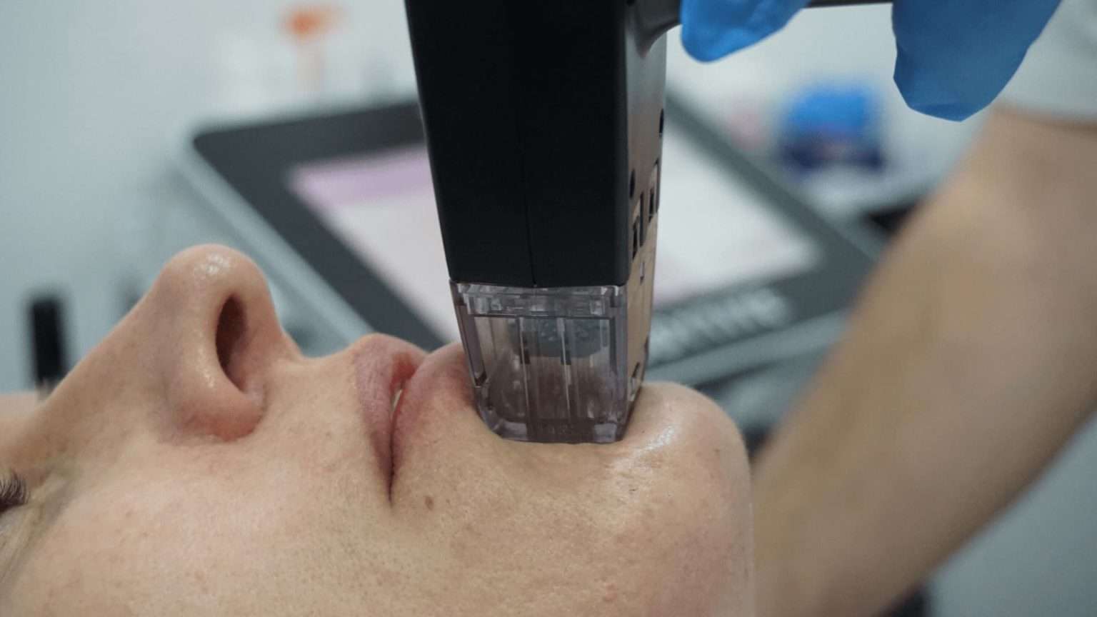 Descubra as diferenças fundamentais entre Ultraformer e Morpheus, dois tratamentos revolucionários para rejuvenescimento da pele, e saiba qual é o mais adequado para suas necessidades.