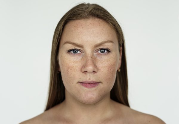 Aprenda a desinflamar e cuidar da pele com melasma. Explore dicas, tratamentos e práticas recomendadas para aliviar a inflamação e melhorar a aparência da pele afetada.