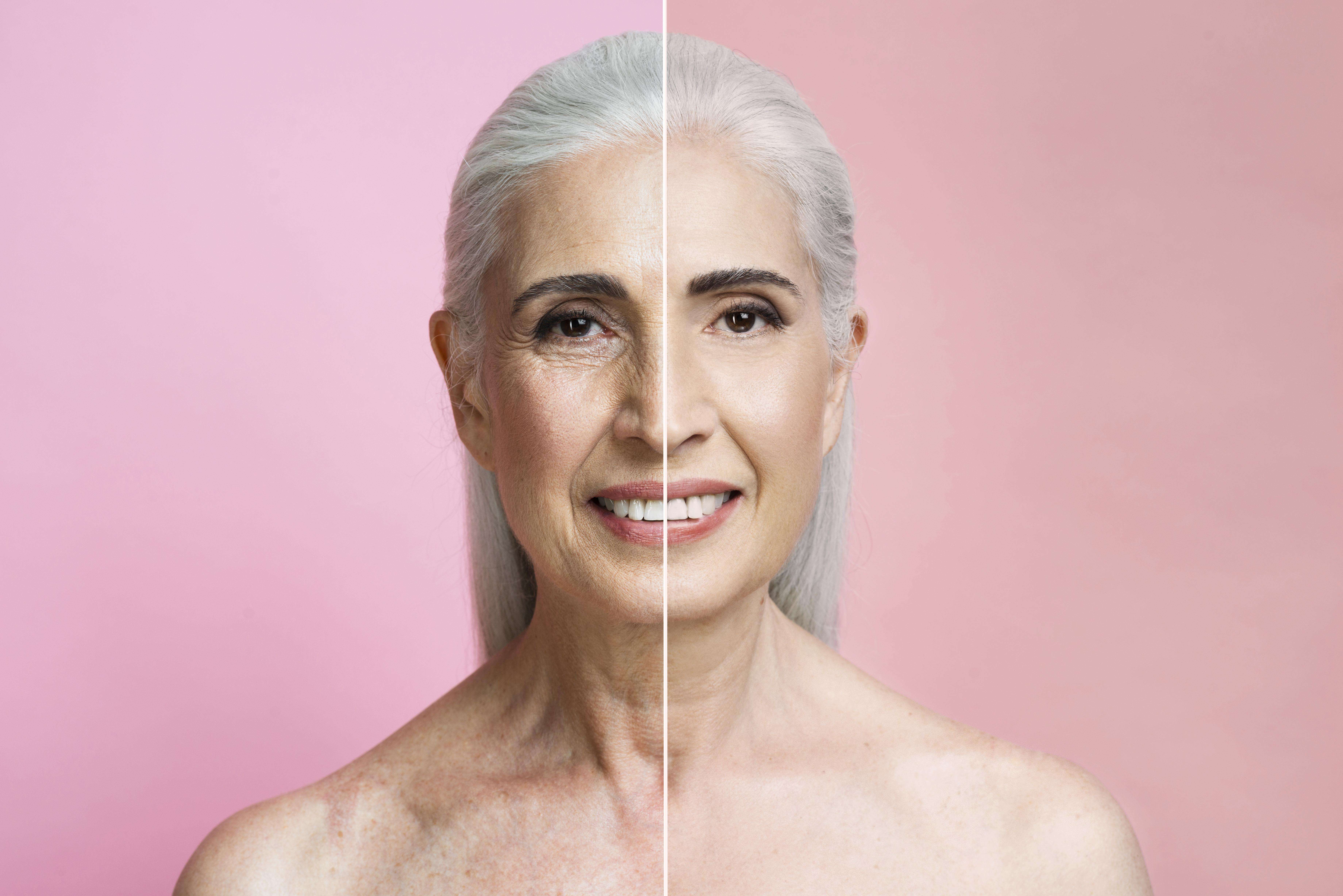 Descubra como o metilfolato, a forma bioativa do ácido fólico, contribui para o rejuvenescimento e a saúde da pele. Explore os benefícios e como incorporar o metilfolato em sua rotina para um visual mais jovem.