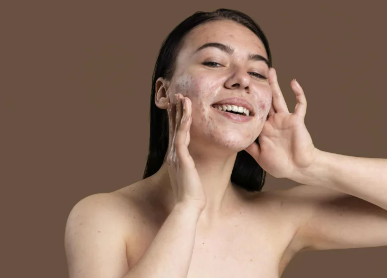 Azelan Gel: Para Que Serve e Como Usar