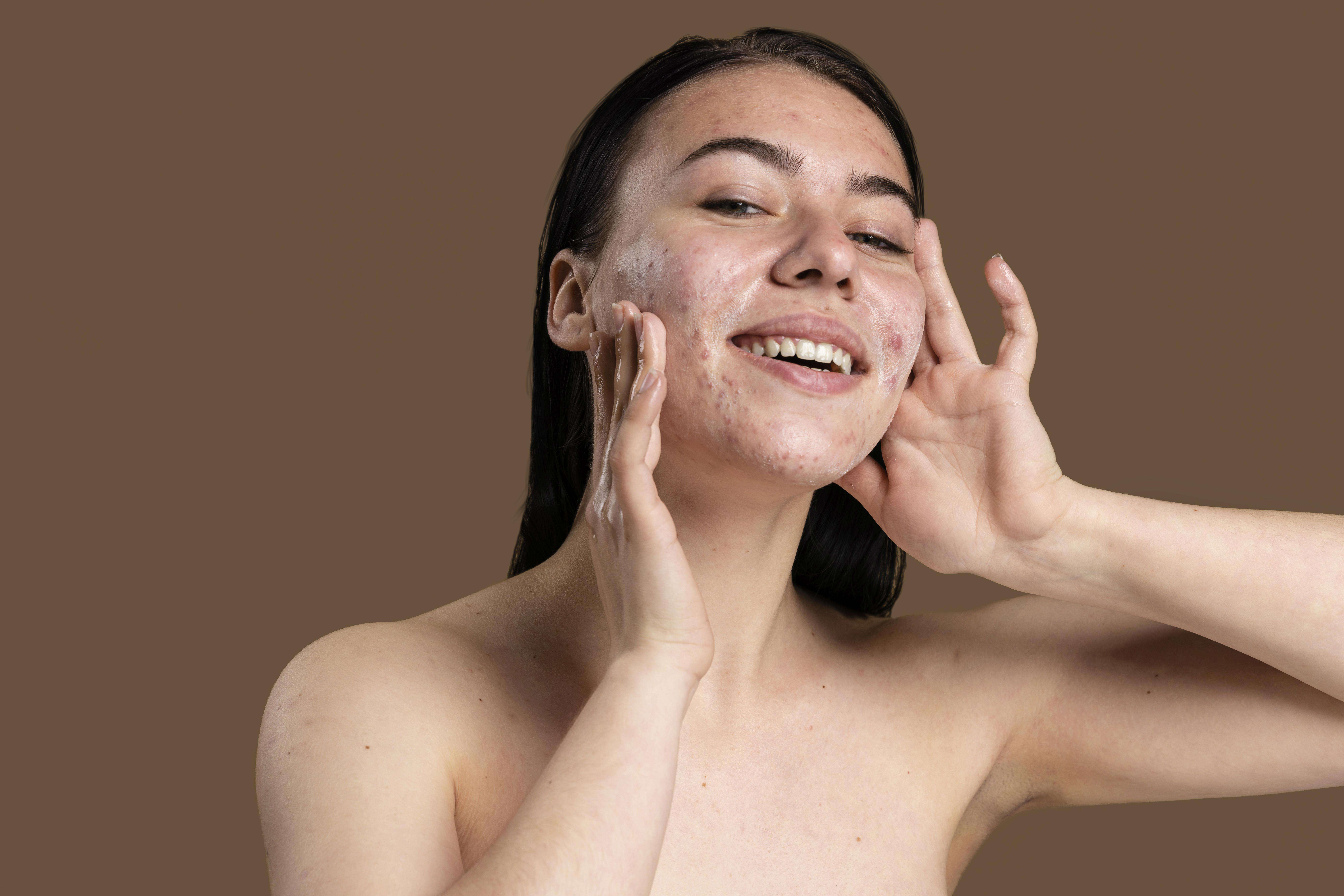 Imagem de um tubo de Azelan Gel, destacando sua eficácia no tratamento de condições dermatológicas como acne e manchas.