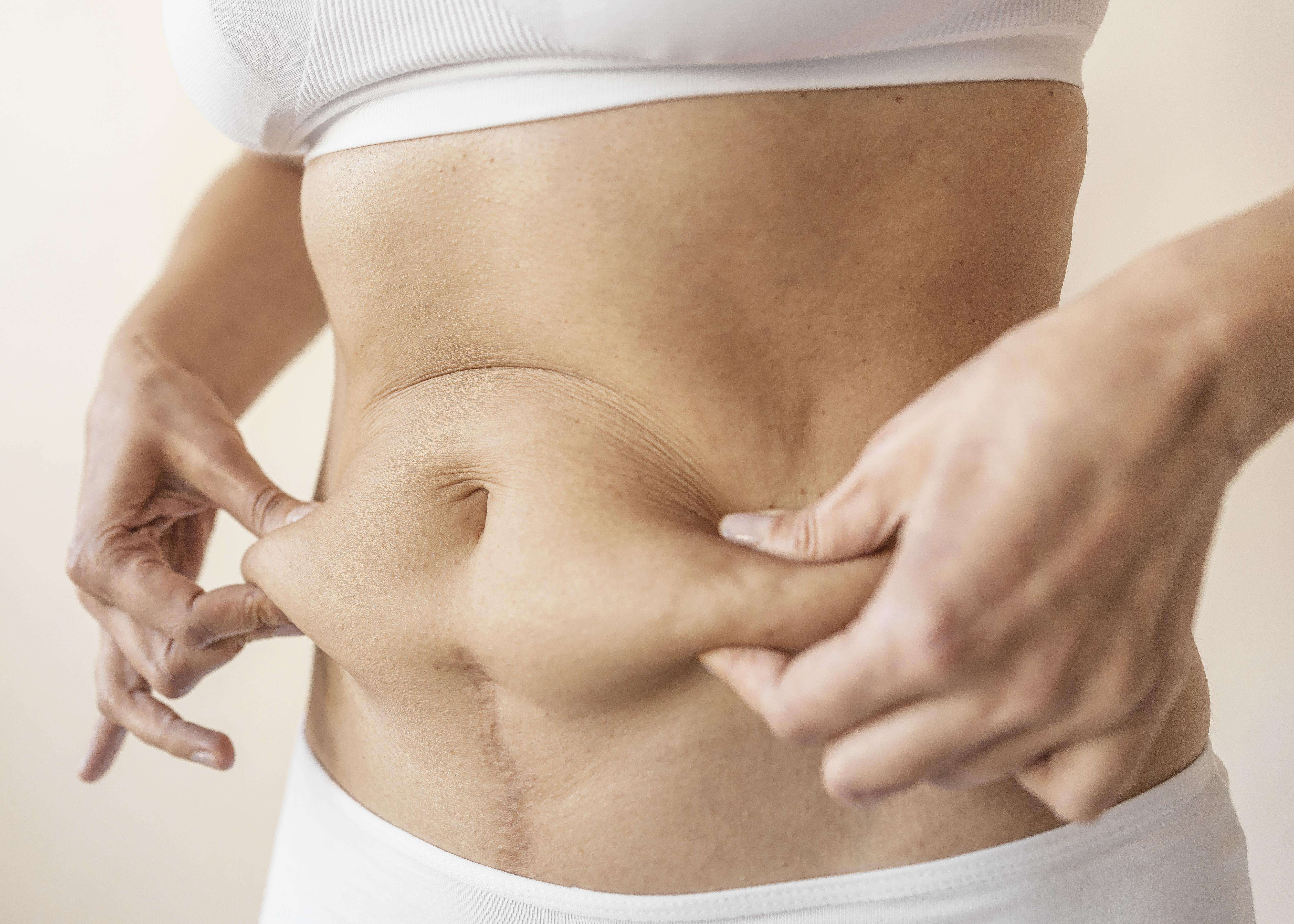 Descubra maneiras eficazes de identificar a diástase abdominal, incluindo técnicas de autoexame e os principais sintomas a observar.