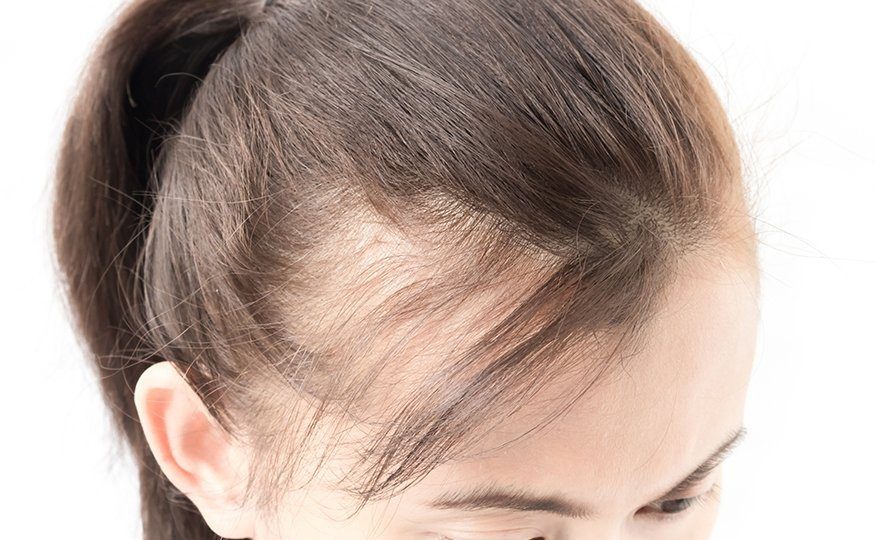 Cabelo ralo? Descubra soluções eficazes para fortalecer e engrossar seus fios, trazendo de volta a vitalidade do seu cabelo!
