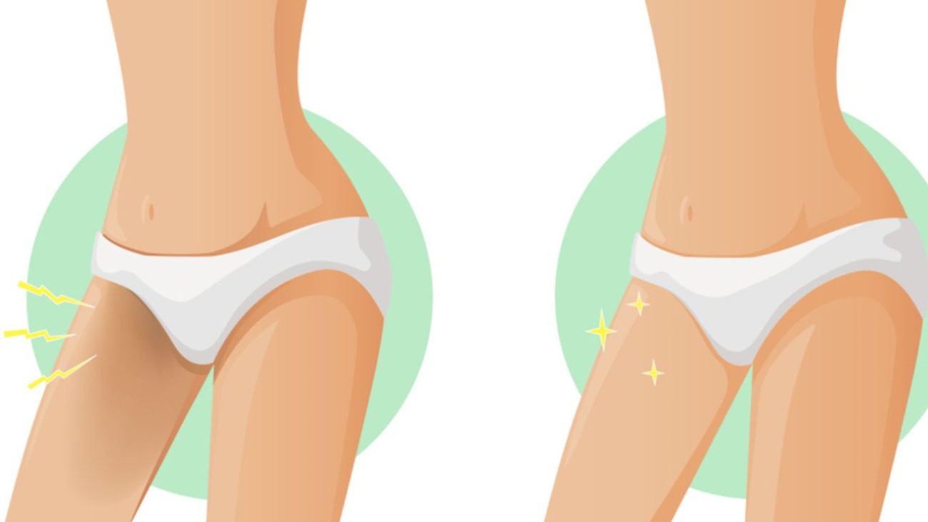 Descubra como clarear a virilha de forma eficaz com nosso guia completo. Explore tratamentos caseiros, produtos recomendados e opções profissionais para uma pele mais clara e uniforme.