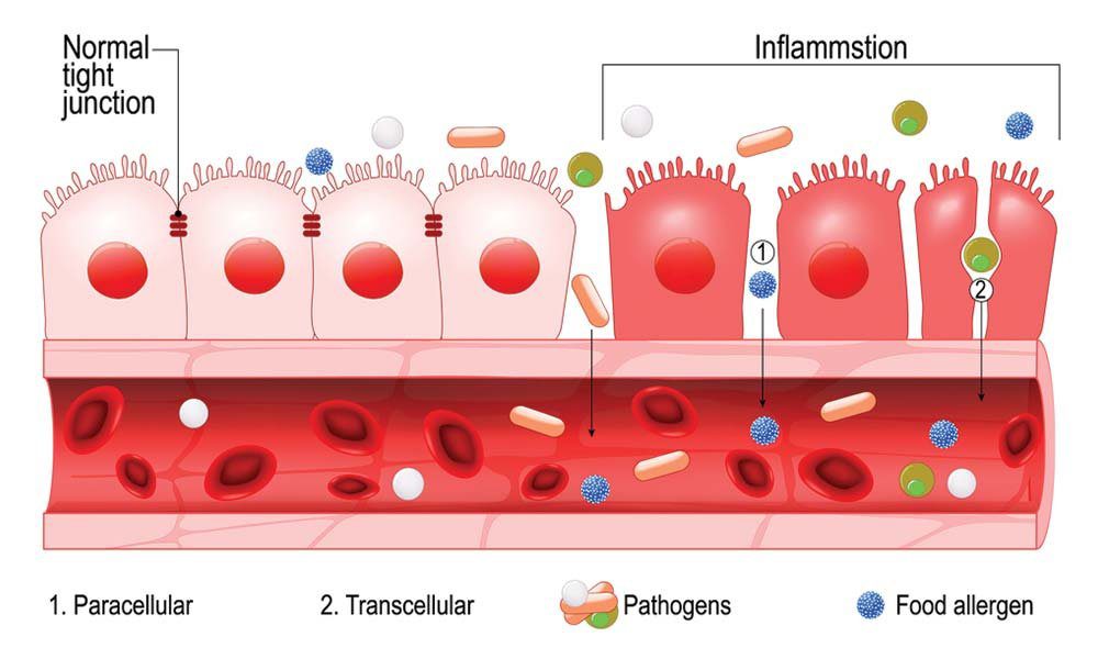 Permeabilidade intestinal: entenda como afeta sua saúde e maneiras de melhorar a função digestiva. Saiba mais!